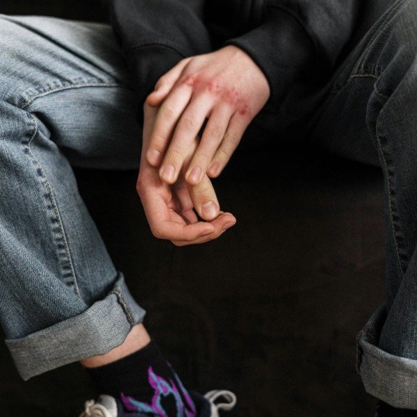 Representación de la desregulación emocional, asociada a impulsividad y dificultad para gestionar emociones, abordada por el Psicólogo Brayan Castañeda en Medellín mediante intervenciones clínicas basadas en evidencia.